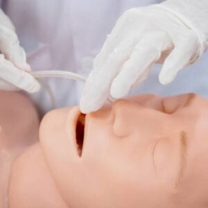NasoGastric Tube Feeding